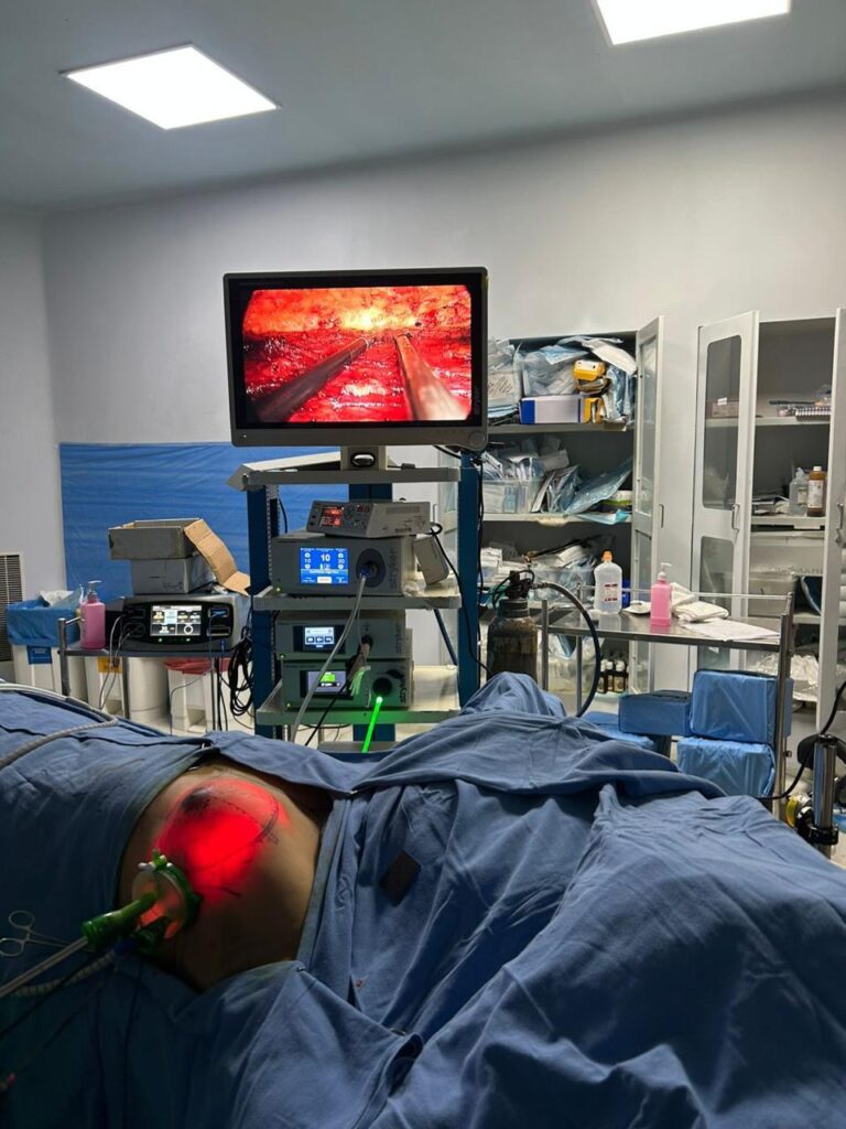 Endoscopic Mastectomy Surgery